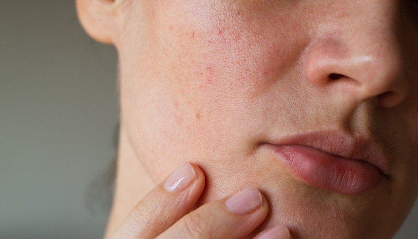 Ova promjena bi mogla biti prvi znak raka pluća