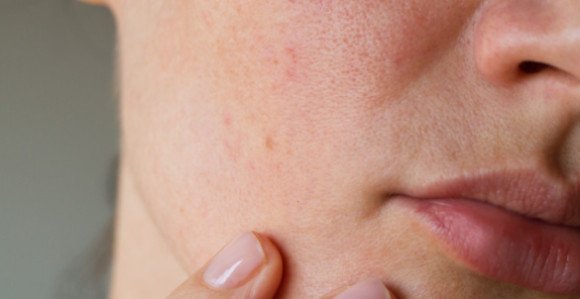 Ova promjena bi mogla biti prvi znak raka pluća